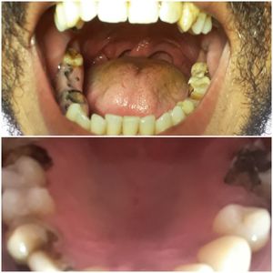 Vaquinha Online - QUERO VOLTAR A SORRIR