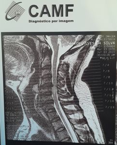 Vaquinha Online - AJUDEM NA CIRURGIA DO AILTON ( DIEGO)