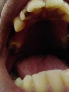 Saúde e Emergências - Restaurar Dentes