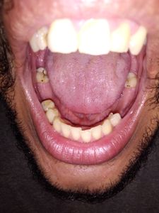 Vaquinha Online - Restaurar Dentes