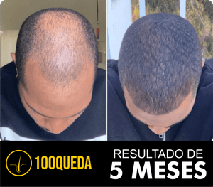 100queda - 100queda Funciona?  É golpe? Reclame Aqui. Saiba tudo sobre o 100queda.