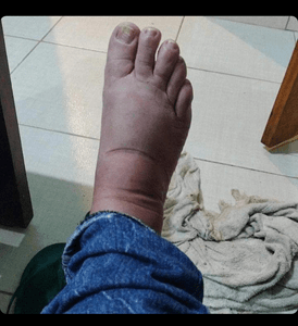 Financiamento Coletivo - Viver após a violência doméstica 