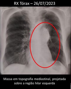 Ajude a dona Dulce - Juntos pela Vida: Apoie dona Dulce em sua luta Contra o Câncer