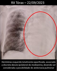 Blumenau/SC - Juntos pela Vida: Apoie dona Dulce em sua luta Contra o Câncer