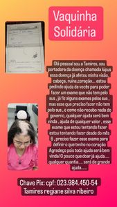 Preciso de ajuda pra fazer exame não fornecido pelo sus