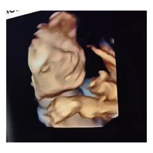 Enxoval da Aurora ❤️