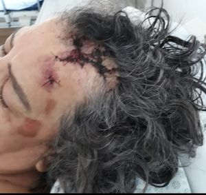 Meu nome é Willis e criei essa vaquinha para arrecadar dinheiro para os gastos e comprar tudo que precisar para recuperação da minha mãe.Ela sofreu um acidente grave de carro com lesão na coluna, tornozelo, quadril e mais de 30 pontos na cabeça.Que Deus abençoe em dobro quem puder ajudar!