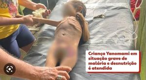 Ajude as crianças do povo Yanomami. Já morreram 570 crianças de desnutrição e fome pela contaminação por mercúrio.  