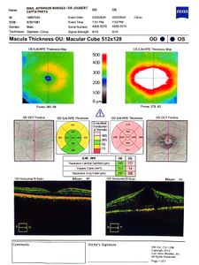 Cirurgia para não perder a visão 