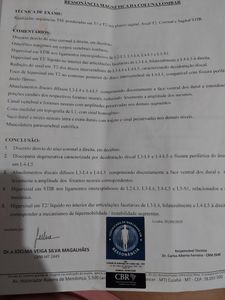 Tratamento fisico mental Alopecia  casa móveis...