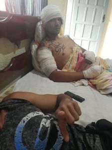 sou Paulo César, mais conhecido "Paulinho da obra", ontem (24/06/2022) sofri acidente!!!!