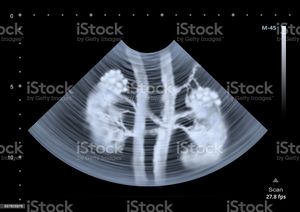 Campanha para fazer minha cirurgia.