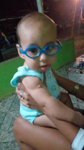 Ajude o bebê Nicolas  com síndrome rara