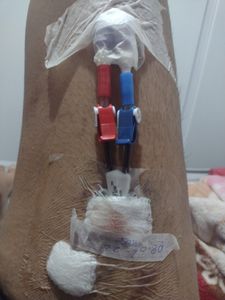 Me ajudem a achar um Rim 