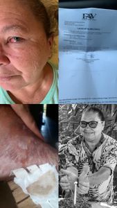 AJUDEM MARIA SEVERINA A ANDAR! AJUDEM MARIA SEVERINA A IR AO MÉDICO E TER SUA MEDICAÇÃO 