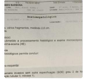 Cirurgia oncologica para a dona Edinalva