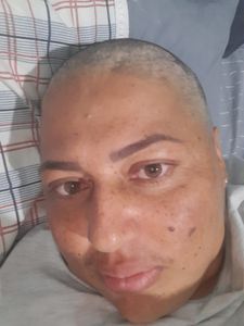 Tratamento de câncer de mama 