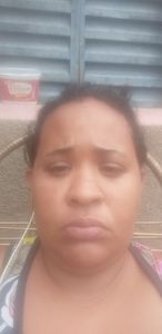 Ola meu nome e Debora estou criando essa campanha para pedir ajuda para minha cerurgia pois nasci com nilpia quando eu fiz exame a sete anos atrás estava 18 grau no olho direito e 20 grau no olho esquerdo ai fiz o exame novamente e deu glaucoma avançado o ofitalmologista disse para mim que estou quase cega pois tenho que fazer uma cirurgia com urgência se eu não fizer vou fica cega