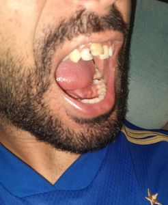 Tratamento Dentário