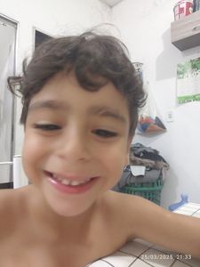 Remédio e Exame Genético CGH ARRAY 