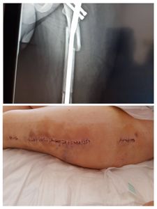 Preciso de ajuda pra tratamento...