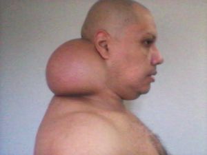 juntos podemos vencer essa luta 