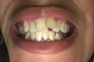 Tratamento odontológico 