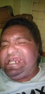 Um sorriso em meio a depressão 