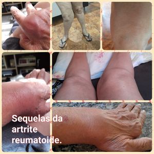 "Minha saúde pede socorro "