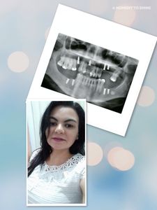 URGENTE! Tratamento Dentário 