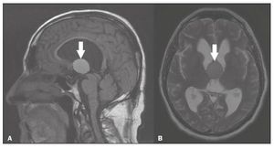 Tratamento e compra de remédios 