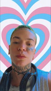 Lucca amaro ajude no meu sonho de mastectomia masculizadora