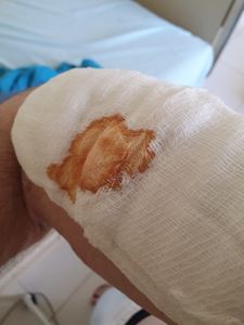 Meu Braço Direito Pede Ajuda