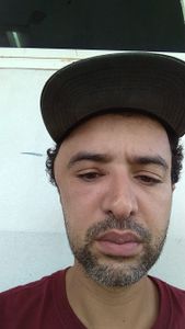 Preciso fazer uma cirurgia urgente pra voltar a trabalhar 