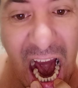 Tratamento dentário