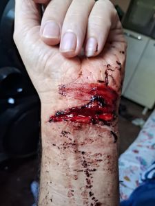 Ajudar a salvar a vida