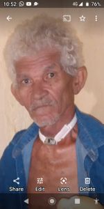 Ajuda Manoel Mauricio Lima Para Cirurgia Laringectomia