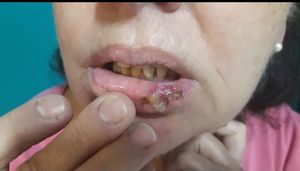 Ajude no tratamento da Ana