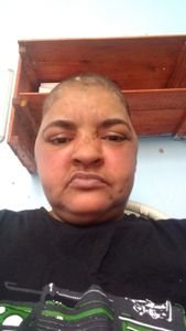 Vamos ajudar Simone à não perder a visão 