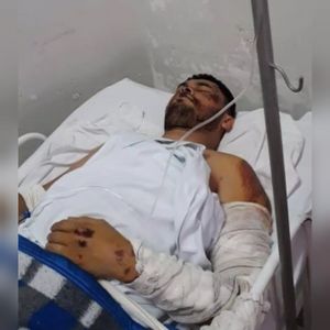 Cirurgia para ambutar a perna