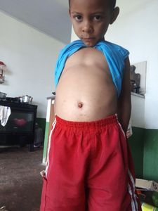 Para cirurgia do meu filho 