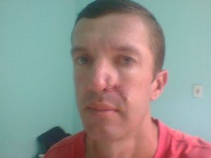 Fazer uma cirurgia urgente 