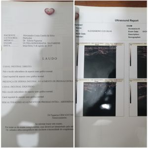 Cirurgia de hernia inguinal 