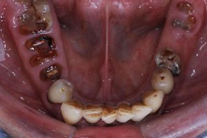 Recuperar minha Vida