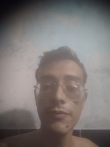 Cirurgia para miopia 