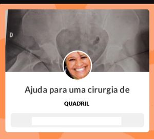 Pedido de Ajuda Financeira para Cirurgia de Quadril