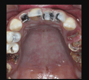 Não é vida não consigo mais comer sem sentir dor, na boca e no estômago de tanto remédio 