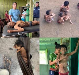 S.O.S YANOMAMI S.O.S