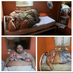 Tratamento para cirurgia 