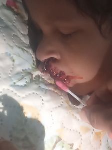 Maria Alice precisa fazer uma cirurgia com urgência 